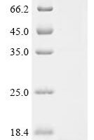Pan troglodytes Cathelicidin antimicrobial peptide (CAMP), partial Recombinant Protein - BioCrest Sci