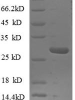 Human Nuclear pore complex protein Nup153 (NUP153), partial Recombinant Protein, N-His - BioCrest Sci