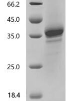 Woodchuck hepatitis B virus Protein X (X),partial Recombinant Protein, C-hFc1 - BioCrest Sci