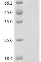 Escherichia coli Valine--tRNA ligase (valS) Recombinant Protein - BioCrest Sci