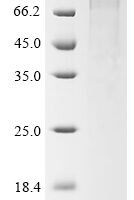 Human Peroxisome proliferator-activated receptor gamma coactivator 1-alpha (PPARGC1A) Recombinant Protein, Tag-Free - BioCrest Sci