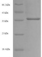 Mouse Low affinity immunoglobulin gamma Fc region receptor III (Fcgr3), partial Recombinant Protein - BioCrest Sci