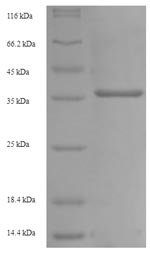 Mouse Low affinity immunoglobulin gamma Fc region receptor III (Fcgr3), partial Recombinant Protein, Mus musculus (Mouse), E.coli, N-terminal 6xHis-SUMO-tagged, 37.2 kDa, purity >≥ 90% as determined by SDS-PAGE.