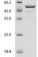 Mouse Ras GTPase-activating-like protein IQGAP1 (Iqgap1), partial Recombinant Protein - BioCrest Sci
