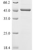Human Histone deacetylase 11 (HDAC11) Recombinant Protein, C-His - BioCrest Sci