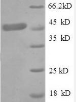 Human Tumor necrosis factor receptor superfamily member 1A (TNFRSF1A), partial Recombinant Protein, N-GST - BioCrest Sci