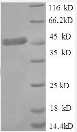 Human Tumor necrosis factor receptor superfamily member 1A (TNFRSF1A), partial Recombinant Protein, N-GST, Homo sapiens (Human), E.coli, N-terminal GST-tagged, 47.2 kDa, purity >≥ 90% as determined by SDS-PAGE.