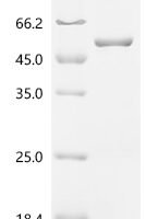 Human Casein kinase II subunit alpha (CSNK2A1) Recombinant Protein, C-His - BioCrest Sci