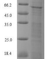 Human DNA-directed DNA/RNA polymerase mu (POLM) Recombinant Protein, N-10His/C-Myc - BioCrest Sci