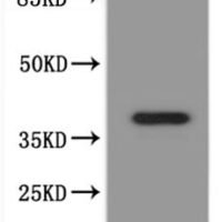 Xenopus laevis paqr8.L&abhd2.S Heterodimer Protein-VLPs Recombinant Protein - BioCrest Sci