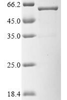 Human Kita-kyushu lung cancer antigen 1 (CT83), partial,Biotinylated Recombinant Protein - BioCrest Sci