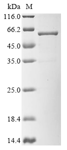 Human Kita-kyushu lung cancer antigen 1 (CT83), partial,Biotinylated Recombinant Protein, Homo sapiens (Human), E.coli, N-terminal MBP-tagged and C-terminal 6xHis-Avi-tagged, 58.1 kDa, purity >≥ 90% as determined by SDS-PAGE.