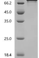 Human Secretogranin-3 (SCG3) Recombinant Protein - BioCrest Sci