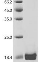 Staphylococcus aureus Immunodominant staphylococcal antigen B (isaB) Recombinant Protein, C-His - BioCrest Sci