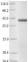 Bovine Pregnancy-associated glycoprotein 1 Recombinant Protein, N-His - BioCrest Sci