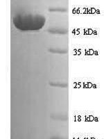 Schizosaccharomyces pombe Sulfide:quinone oxidoreductase, mitochondrial (hmt2) Recombinant Protein, N-His - BioCrest Sci