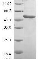 Human Homeobox protein VENTX (VENTX) Recombinant Protein - BioCrest Sci