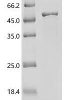 Mouse Actin-related protein 2/3 complex subunit 1B (Arpc1b) Recombinant Protein - BioCrest Sci
