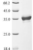 Trachypithecus cristatus Cytochrome c oxidase subunit 7A1, mitochondrial (COX7A1), partial Recombinant Protein, C-hFc1 - BioCrest Sci