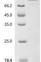 Human Putative butyrophilin-like protein 10 pseudogene (BTNL10P), partial Recombinant Protein, C-10His-HSA - BioCrest Sci