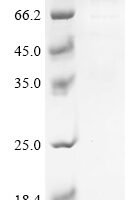 Human Endogenous retrovirus group K member 6 Env polyprotein (ERVK-6), partial,Biotinylated Recombinant Protein - BioCrest Sci