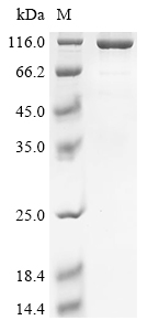 Human Endogenous retrovirus group K member 6 Env polyprotein (ERVK-6), partial,Biotinylated Recombinant Protein, Homo sapiens (Human), E.coli, N-terminal MBP-tagged and C-terminal 6xHis-Avi-tagged, 109.3 kDa, purity >≥ 85% as determined by SDS-PAGE.