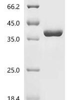 Escherichia coli NAD kinase (nadK) Recombinant Protein - BioCrest Sci