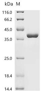 Escherichia coli NAD kinase (nadK) Recombinant Protein, Escherichia coli (strain K12), E.coli, C-terminal 6xHis-tagged, 39.5 kDa, purity >≥ 95% as determined by SDS-PAGE.
