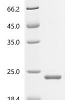 Human Bromodomain-containing protein 4 (BRD4), partial Recombinant Protein, C-His, aa 342–460 - BioCrest Sci