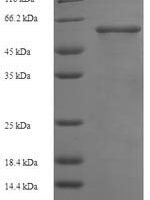 Human Mothers against decapentaplegic homolog 3 (SMAD3) Recombinant Protein, N-His-SUMO - BioCrest Sci