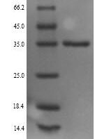 Mouse Monoglyceride lipase (Mgll) Recombinant Protein, N-His - BioCrest Sci
