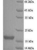 Influenza B virus Nucleoprotein (NP), partial Recombinant Protein, N-His - BioCrest Sci
