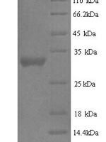 Human Protein delta homolog 2 (DLK2), partial Recombinant Protein - BioCrest Sci