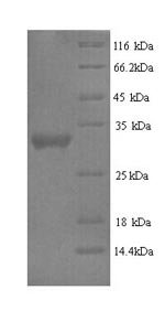 Human Protein delta homolog 2 (DLK2), partial Recombinant Protein, Homo sapiens (Human), Yeast, N-terminal 6xHis-tagged, 31.8 kDa, purity >≥ 90% as determined by SDS-PAGE.