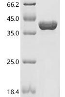 Pseudomonas aeruginosa Type III secretion system protein (pcrV) Recombinant Protein - BioCrest Sci