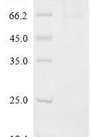 Rat Coiled-coil domain containing 112 (Ccdc112) Recombinant Protein, C-His - BioCrest Sci