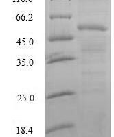 Human Splicing factor U2AF 35 kDa subunit (U2AF1) Recombinant Protein - BioCrest Sci