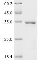 Human Egl nine homolog 3 (EGLN3) Recombinant Protein - BioCrest Sci