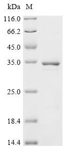 Human Egl nine homolog 3 (EGLN3) Recombinant Protein, Homo sapiens (Human), E.coli, C-terminal 6xHis-tagged, 34.1 kDa, purity >≥ 85% as determined by SDS-PAGE.