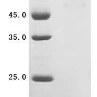 Human Atrial natriuretic peptide receptor 2 (NPR2), Partial Recombinant Protein - BioCrest Sci