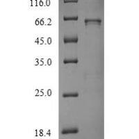 Human UDP-glucuronosyltransferase 1A1 (UGT1A1) Recombinant Protein - BioCrest Sci