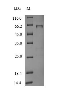 Human UDP-glucuronosyltransferase 1A1 (UGT1A1) Recombinant Protein, Homo sapiens (Human), Yeast, N-terminal 6xHis-tagged, 59.1 kDa, purity >≥ 90% as determined by SDS-PAGE.