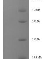 Mouse Desmoglein-3 (Dsg3), partial Recombinant Protein, N-His-SUMO - BioCrest Sci