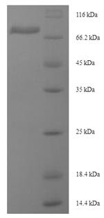 Mouse Desmoglein-3 (Dsg3), partial Recombinant Protein, N-His-SUMO, Mus musculus (Mouse), E.coli, N-terminal 6xHis-SUMO-tagged, 79.2 kDa, purity >≥ 90% as determined by SDS-PAGE.
