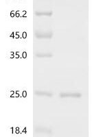 Mouse Microtubule-associated proteins 1A/1B light chain 3B (Map1lc3b) Recombinant Protein - BioCrest Sci