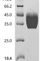 Mouse Tissue factor(F3), partial Recombinant Protein - BioCrest Sci