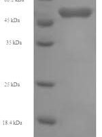Human Succinyl-CoA:3-ketoacid-coenzyme A transferase 1, mitochondrial (OXCT1) Recombinant Protein - BioCrest Sci