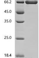 Human albumin (ALB) Recombinant Protein - BioCrest Sci