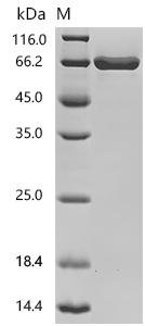 Human albumin (ALB) Recombinant Protein, Homo sapiens (Human), Mammalian cell, C-terminal 10xHis-tagged, 68.6 kDa, purity >≥ 95% as determined by SDS-PAGE.