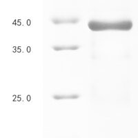 Chlamydia trachomatis Virulence plasmid protein pGP3-D Recombinant Protein, N-His-SUMO - BioCrest Sci